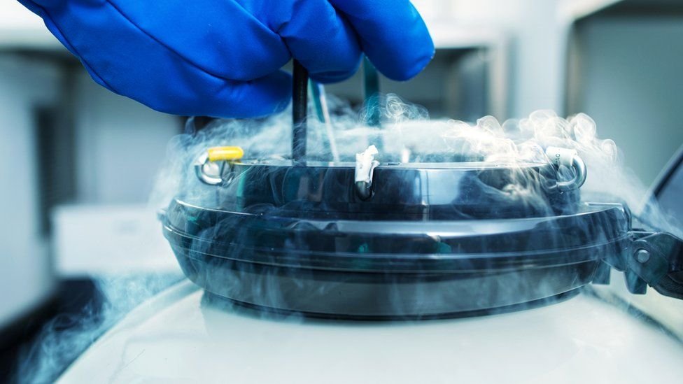 Egg Freezing/Fertility Preservation