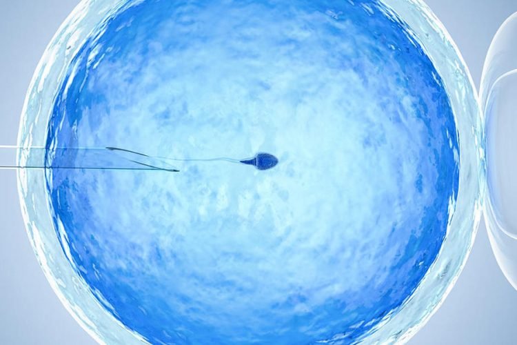 IVF/ ICSI